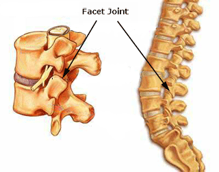 Facet Joint Injuries Diagram