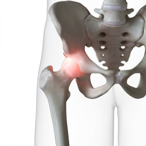 SI Joint Injuries 3D