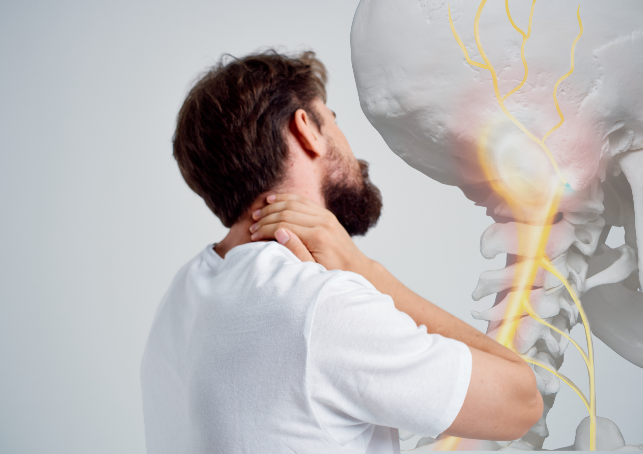 Man with dark hair and beard wearing a white t-shirt holding the back of his neck with one hand, with a transparent 3D anatomical overlay showing the cervical spine vertebrae and nerve pathways highlighted in yellow with inflammation indicators, illustrating neck pain and cervical nerve irritation.